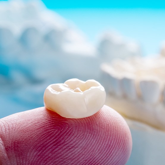 There are many factors that could affect the cost of a dental crown