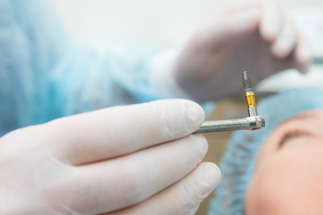 Up-close view of dental implant