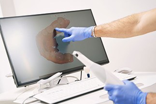 Gloved hands holding dental scanner and pointing at computer monitor